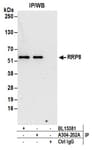 Detection of human RRP8 by western blot of immunoprecipitates.