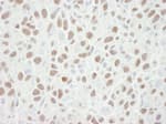 Detection of mouse MCM6 by immunohistochemistry.