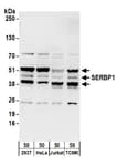 Detection of human and mouse SERBP1 by western blot.