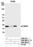 Detection of human MAD2 by western blot of immunoprecipitates.