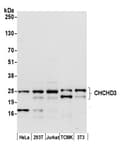 Detection of human and mouse CHCHD3 by western blot.