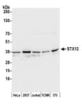 Detection of human and mouse STX12 by western blot.