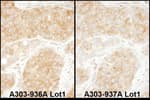 Detection of human RPS11 by immunohistochemistry.