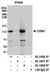 Detection of CRM1 (Exportin 1) by immunoprecipitation.