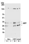 Detection of human and mouse MFF by western blot.