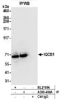 Detection of human IQCB1 by western blot of immunoprecipitates.