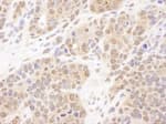 Detection of mouse PSMB7 by immunohistochemistry.