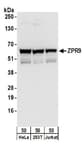 Detection of human ZPR9 by western blot.
