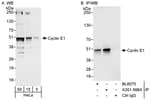 Detection of human Cyclin E1 by western blot and immunoprecipitation.