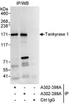 Detection of human Tankyrase 1 by western blot of immunoprecipitates.