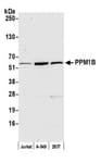 Detection of human PPM1B by western blot.
