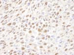 Detection of mouse VCP by immunohistochemistry.