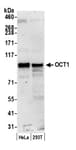 Detection of human OCT1 by western blot.