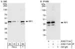 Detection of human RP1 by western blot and immunoprecipitation.