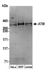 Detection of human ATM by western blot.
