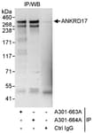 Detection of human ANKRD17 by western blot of immunoprecipitates.