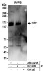 Detection of human CR2 by western blot of immunoprecipitates.