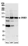 Detection of human SRBD1 by western blot.