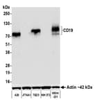 Detection of mouse CD19 by western blot.