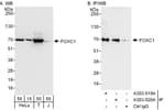 Detection of human FOXC1 by western blot and immunoprecipitation.