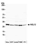 Detection of human and mouse NOL12 by western mlot.