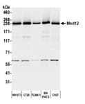 Detection of mouse MED12 by western blot.