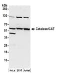 Detection of human Catalase/CAT by western blot.