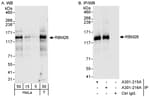 Detection of human RBM26 by western blot and immunoprecipitation.
