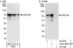 Detection of human ZNF326 by western blot and immunoprecipitation.