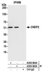 Detection of human CNDP2 by western blot of immunoprecipitates.