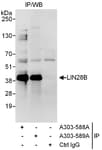Detection of human LIN28B by western blot of immunoprecipitates.