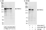 Detection of human TRPS1 by western blot and immunoprecipitation.