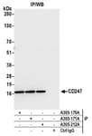 Detection of human CD247 by western blot of immunoprecipitates.