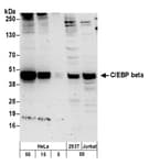 Detection of human C/EBP beta by western blot.