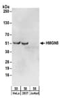 Detection of human HMGN5 by western blot.