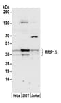 Detection of human RRP15 by western blot.
