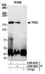 Detection of human TSC2 by western blot of immunoprecipitates.