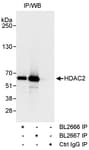Detection of human HDAC2 by western blot of immunoprecipitates.