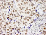Detection of human ZNF261 by immunohistochemistry.