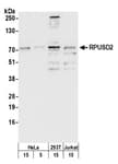 Detection of human RPUSD2 by western blot.
