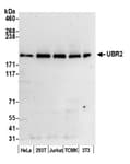 Detection of human and mouse UBR2 by western blot.