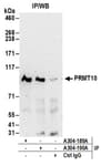 Detection of human PRMT10 by western blot of immunoprecipitates.