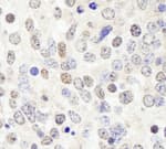 Detection of mouse HDAC7 by immunohistochemistry.