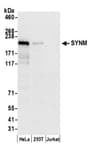 Detection of human SYNM by western blot.