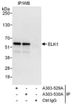 Detection of human ELK1 by western blot of immunoprecipitates.