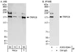 Detection of human TRPC6 by western blot and immunoprecipitation.