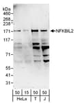 Detection of human NFKBIL2 by western blot.