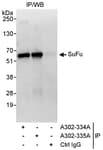 Detection of human SuFu by western blot of immunoprecipitates.