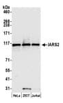 Detection of human IARS2 by western blot.