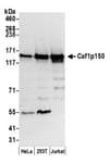 Detection of human Caf1p150 by western blot.